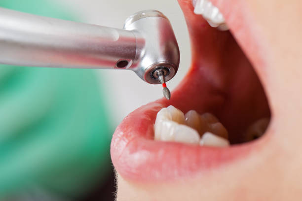 Best Dentist for Dental Trauma  in Easton, CA